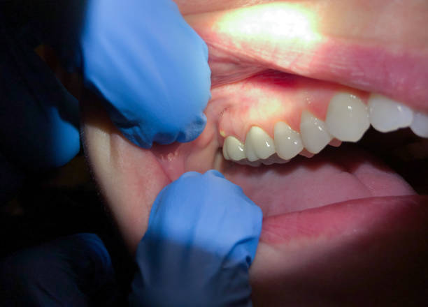 Best Broken or Cracked Tooth Emergency Dentist in Grant, MI