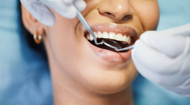 Best Emergency Dentist for Lost Fillings or Crowns in Grant, MI